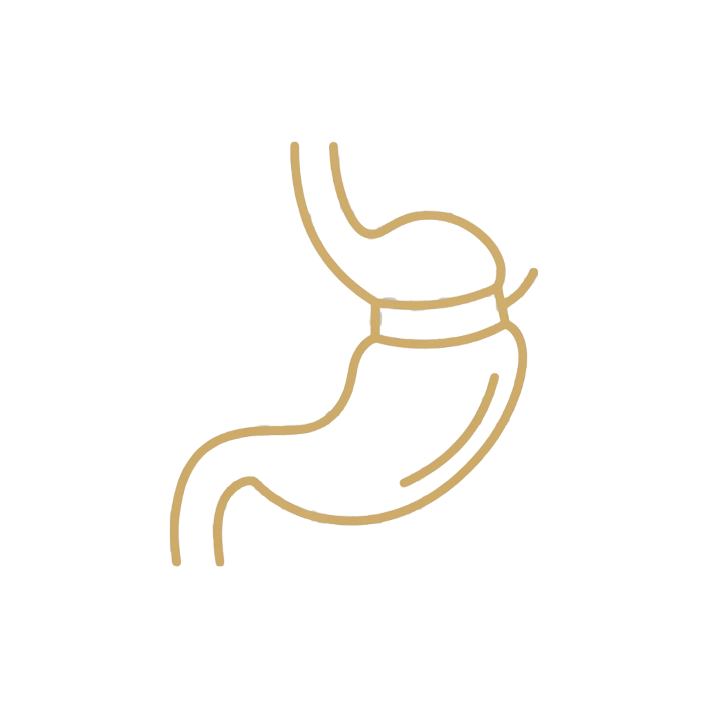 Grafik eines Magenbandes welches mit Hypnose installiert werden kann